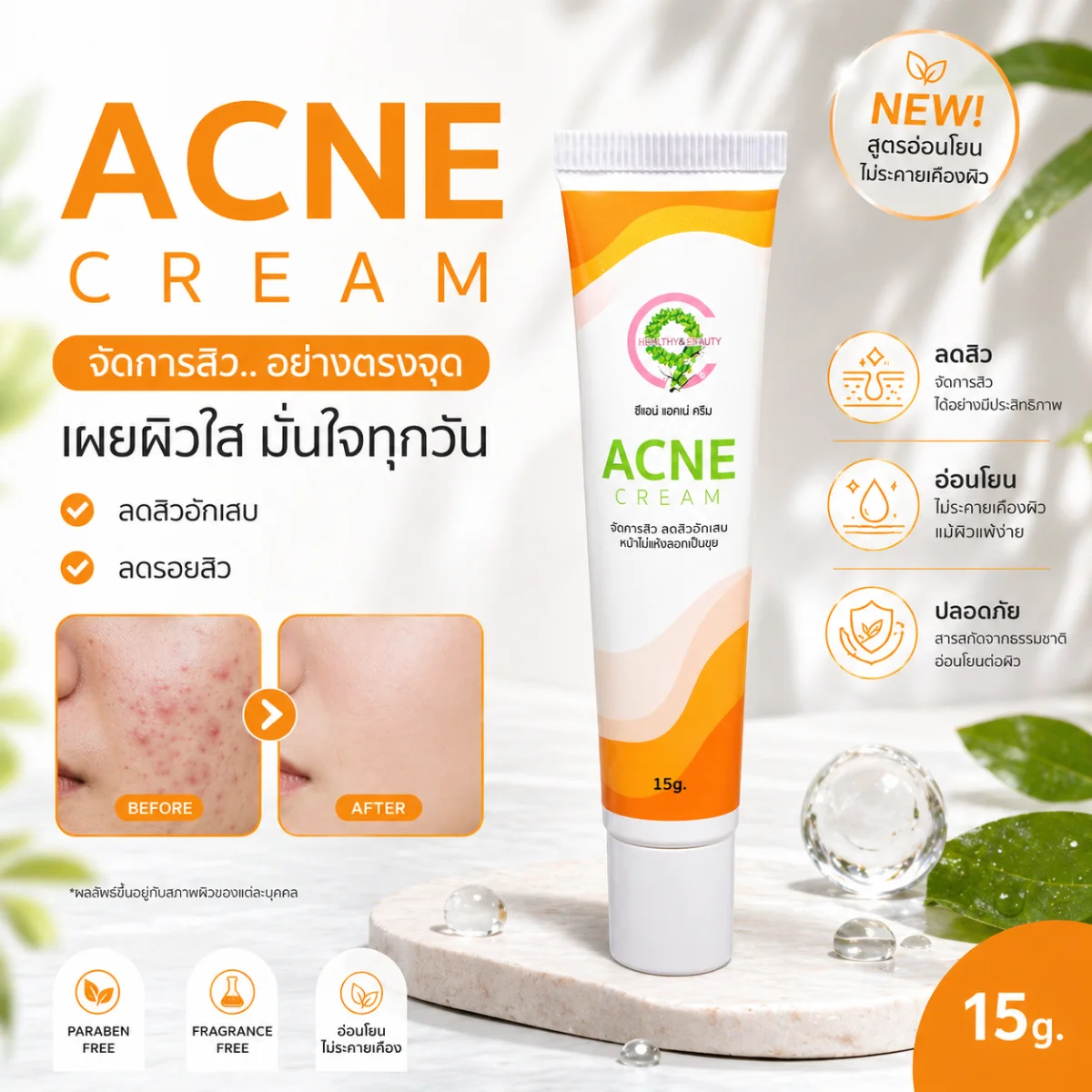 C9 ACNE CREAM ซีไนน์ แอคเน่ ครีม ผลิตภัณฑ์บำรุงผิวหน้า (สิวอุดตัน)