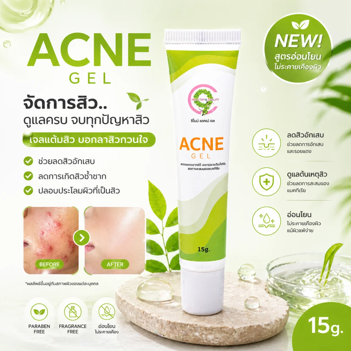 C9 Acne Gel เจลแต้มสิวอักเสบ | ยุบไว ไม่ทิ้งรอย